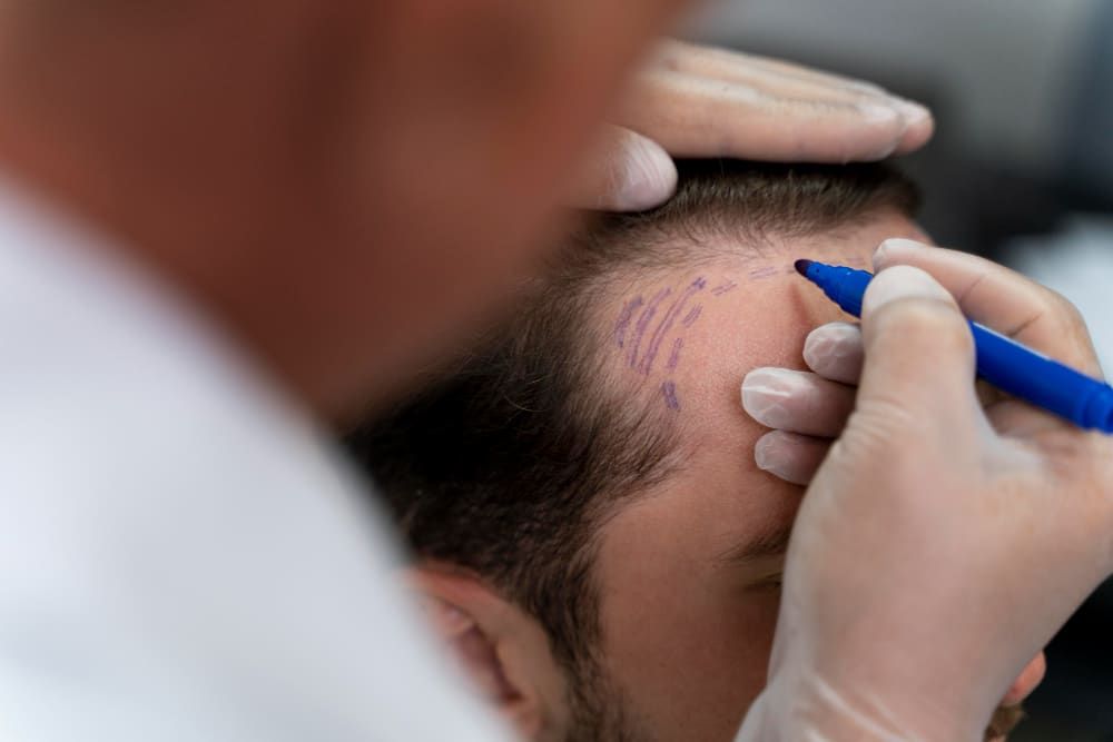 Natürliche Haarlinien
