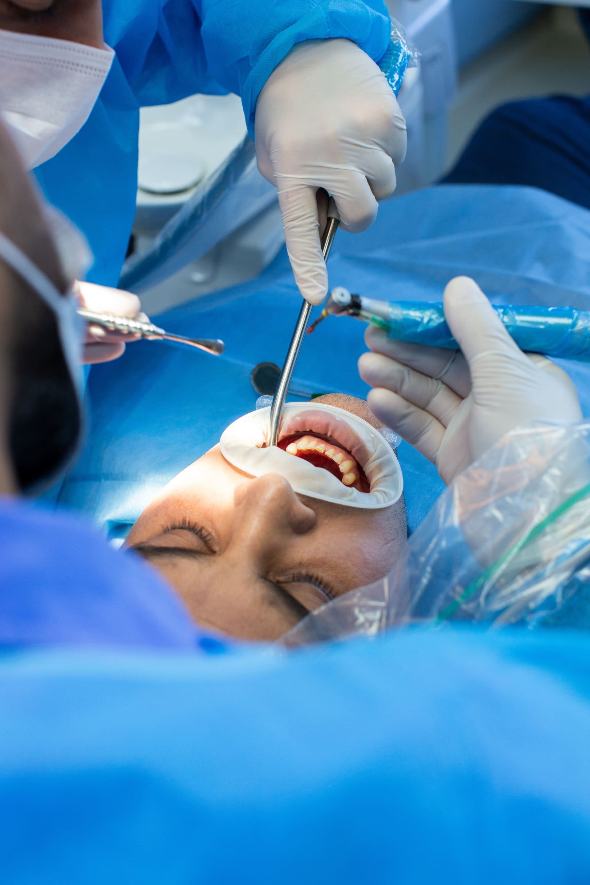 Zahnchirurgie