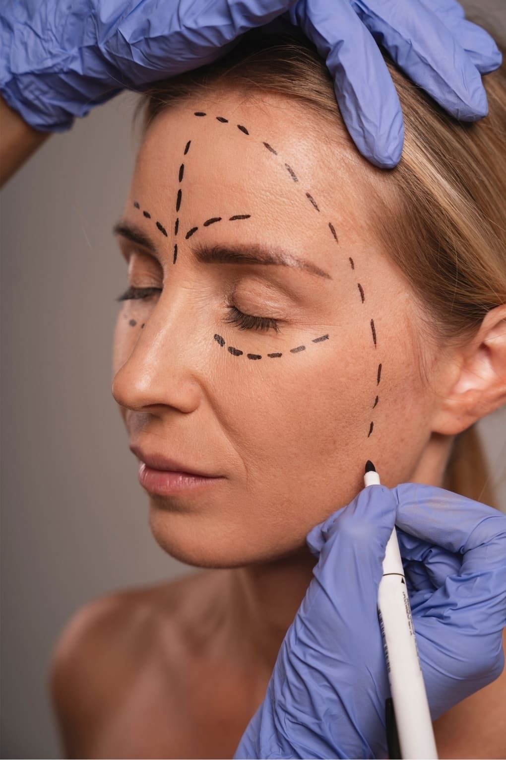 Plastische Chirurgie